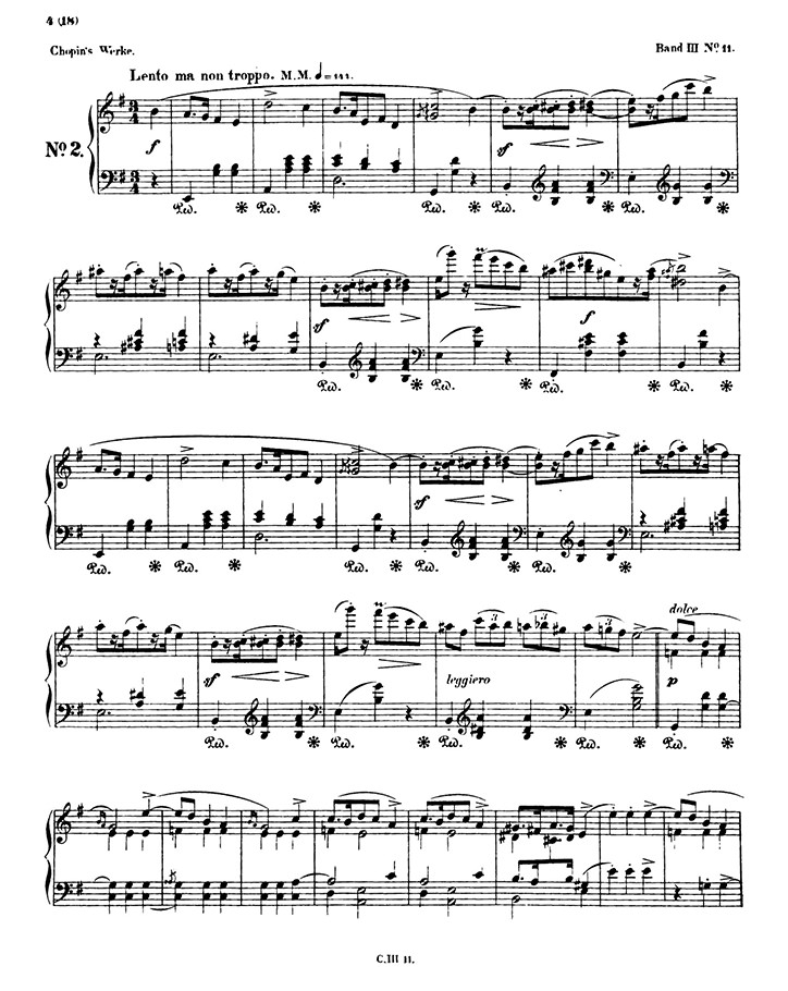 ショパン：マズルカ第11番 Op.17 No.2 / ブライトコプフ・ウント・ヘルテル サンプル
